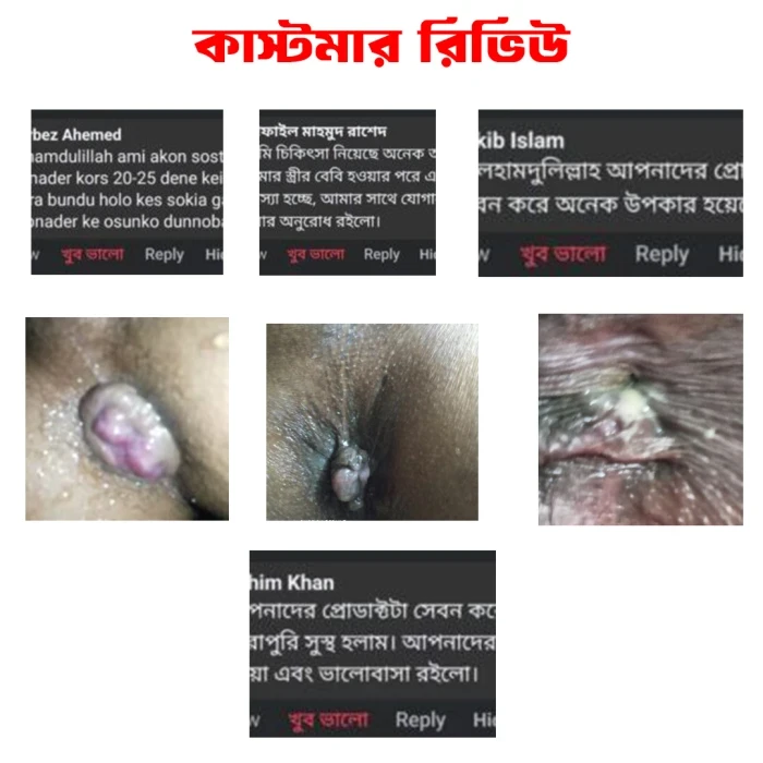 এলিট পিওর পাইলস কেয়ার
